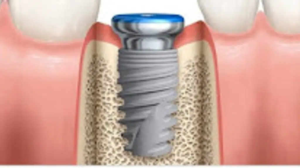 Dr. Smital Nitin Pawar. Ujjwal Dental Clinic