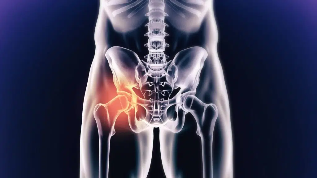 Dr. Shivade Nishant  Trauma and Joint Replacement Surgeon