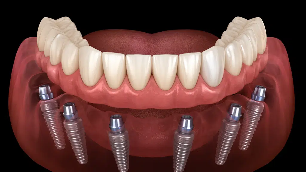 Relax Dental Spa