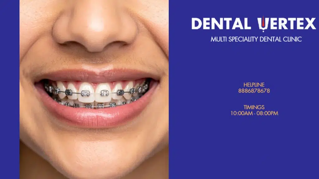 Dental Vertex