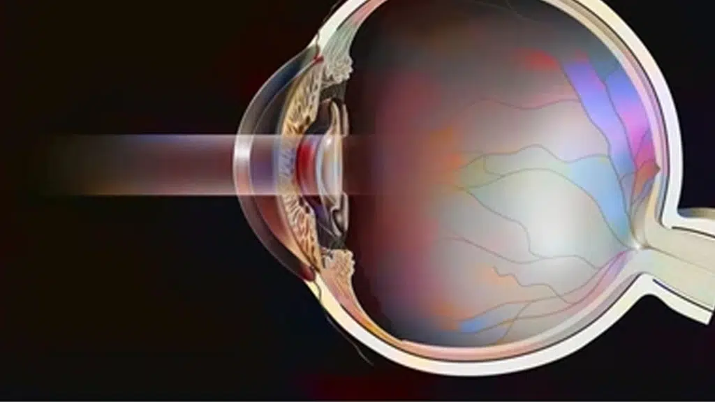 D. K Eye Care Hospital