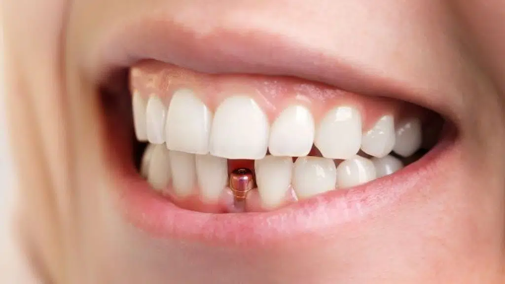 Smile Avenue Dental Clinic
