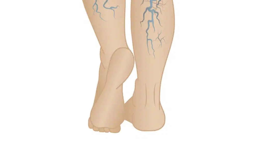 The Vein Center