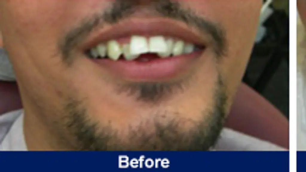 Root Canal Centre