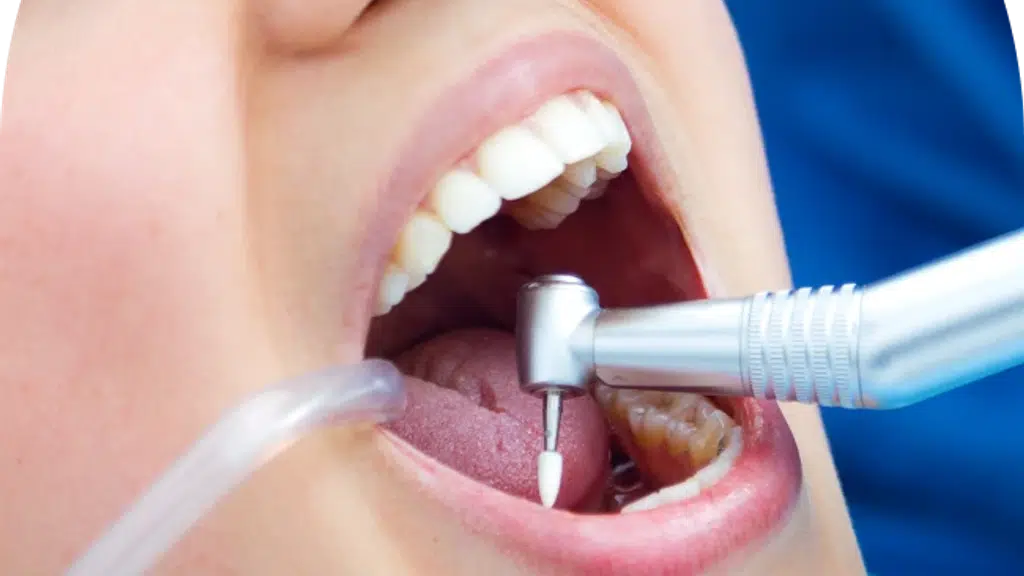 Align Dental Clinic