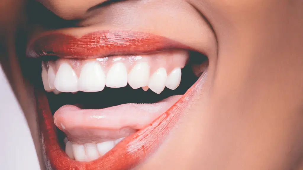 Pride Dental Care