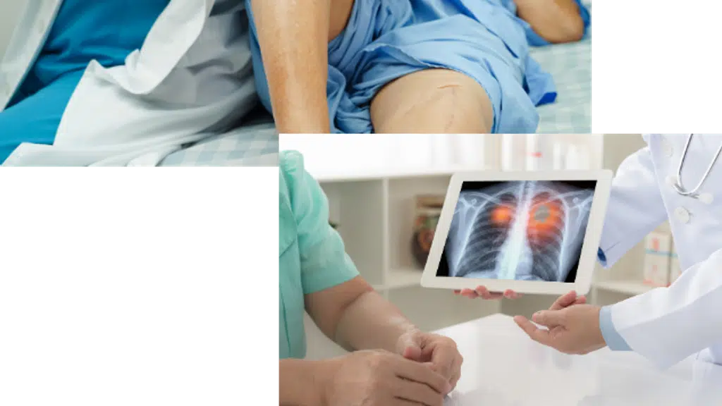 Dr Priyanshu Dixit- Best Orthopedic doctor ACL, Knee & Hip Replacement Surgeon in Jabalpur.