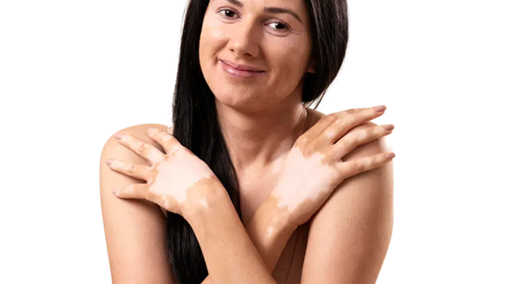Banaras Plastic Surgery Hospital