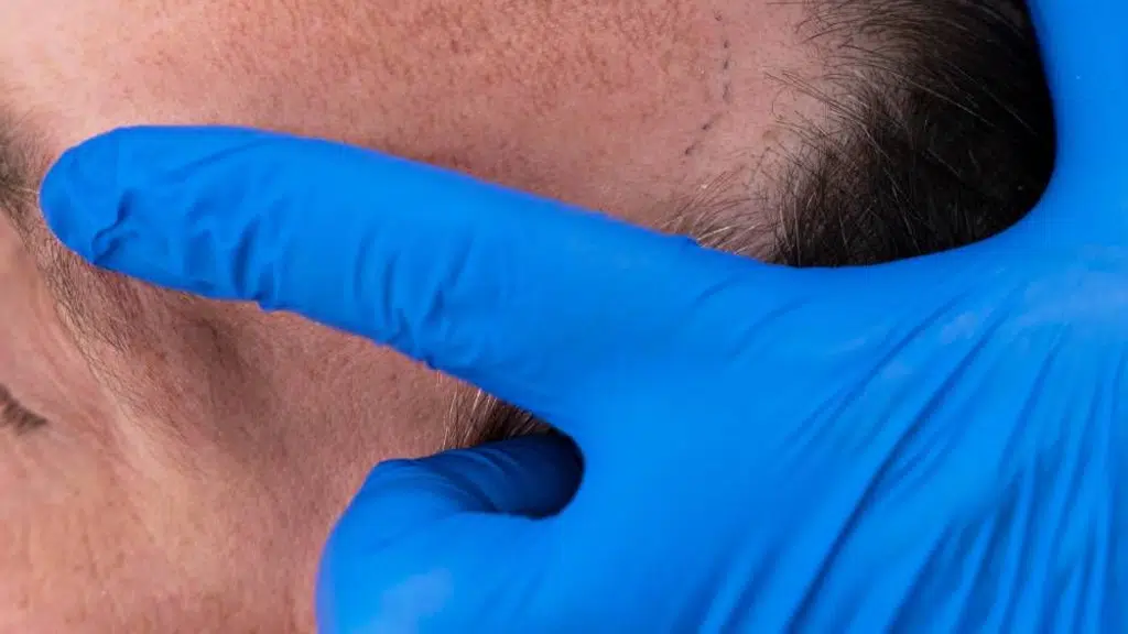 Dermaplast Skin, Laser and Hair Clinic