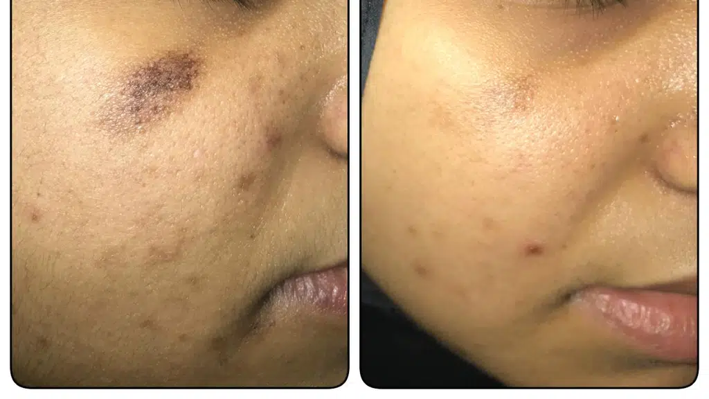 Skinvel Hair and Skin Clinic