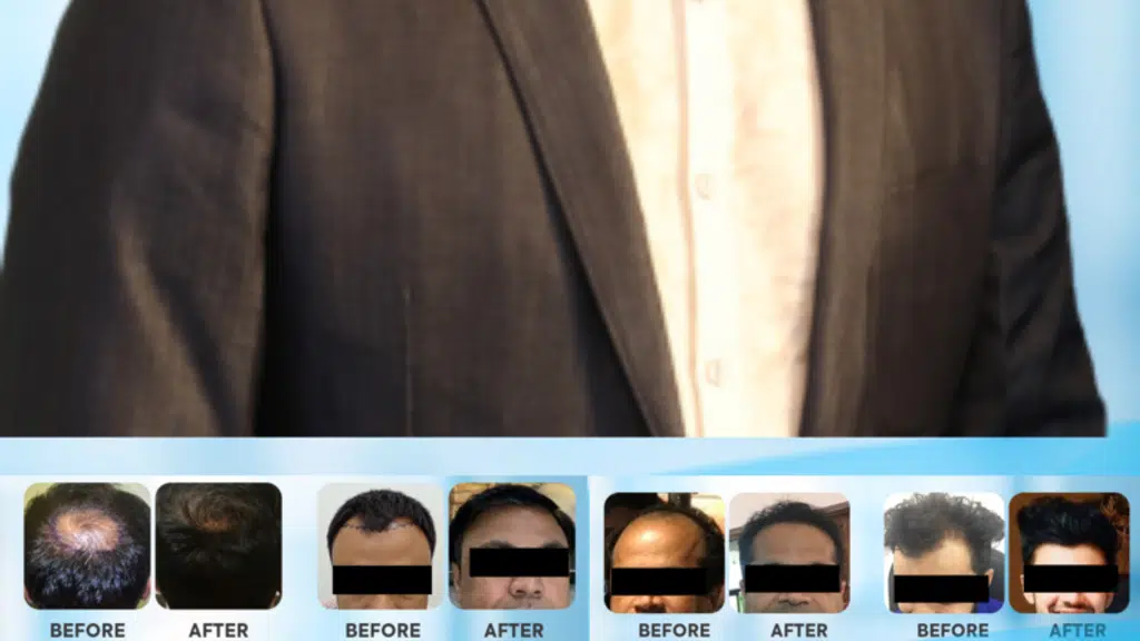 Chandrashekhar skin and hair clinic