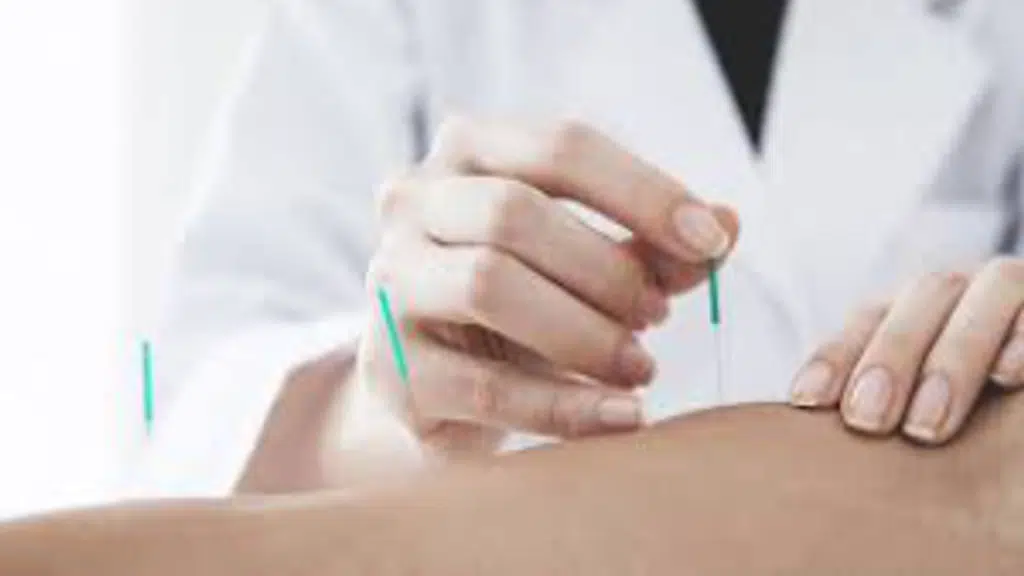 Nalam India Acupuncture Clinic
