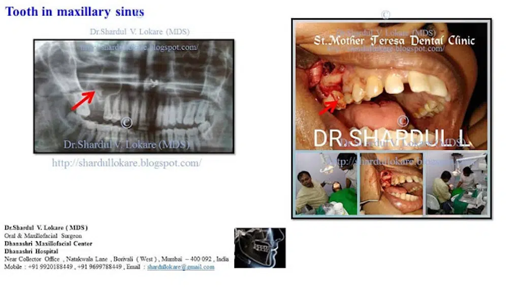 Dhanashri Dental & Maxillofacial Centre