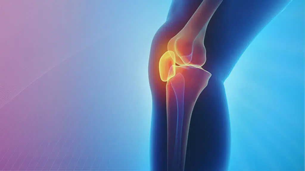 JOINT PAIN Superspeciality centre-Rheumatology clinic