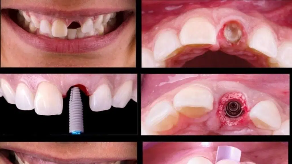 Ideal Dental Care