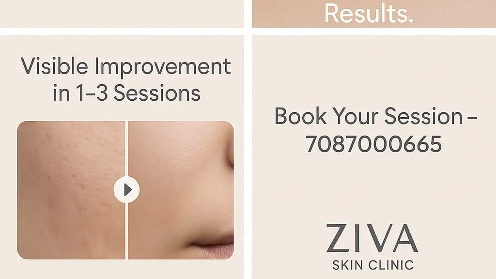 Ziva Skin Clinic, Coimbatore