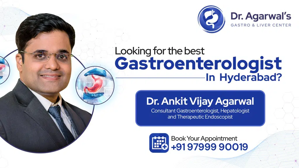 Dr. Ankit Vijay Agarwal - Gastroenterologist