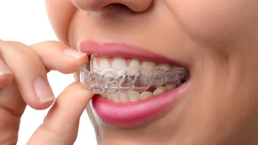 Singh Dental Clinic