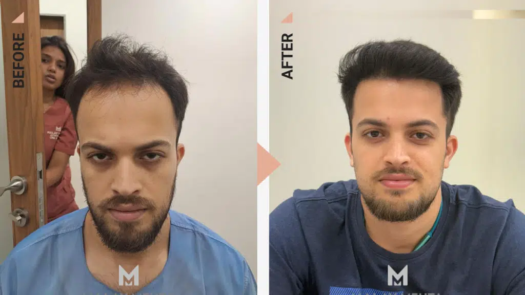 Malay Mehta Aesthetic Clinic