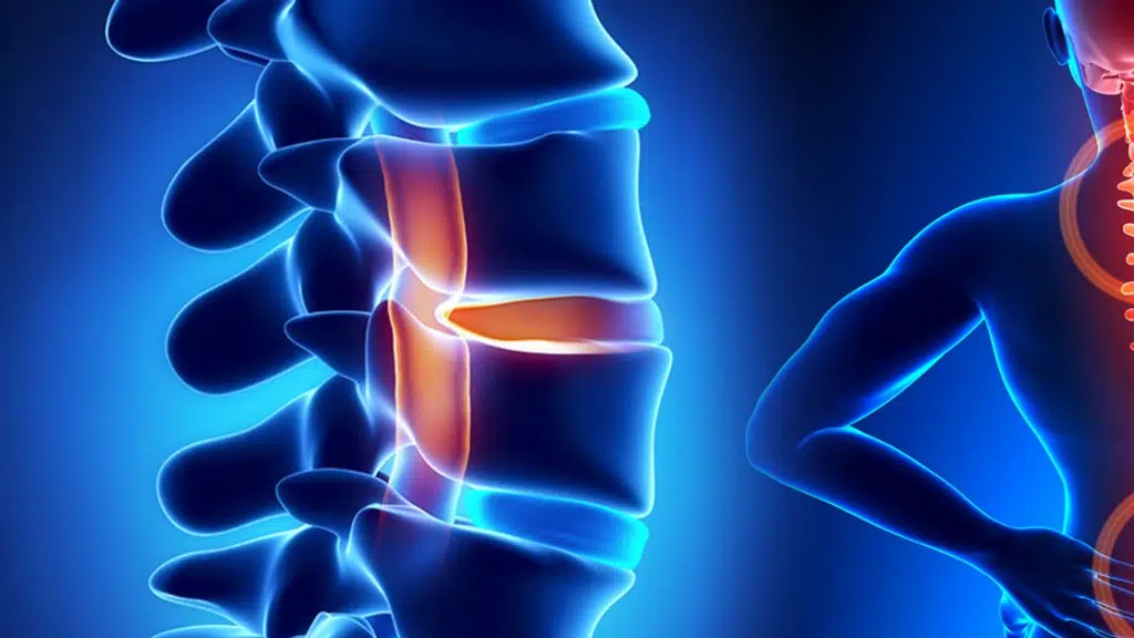 Dr. Amit Barala Neurospine Surgeon