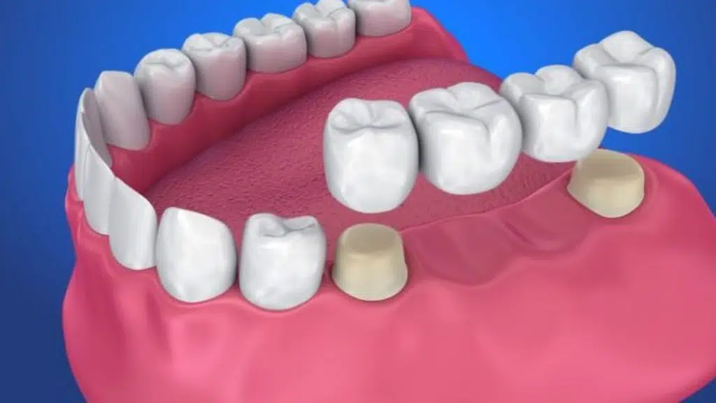 Dentaline Dental Clinic