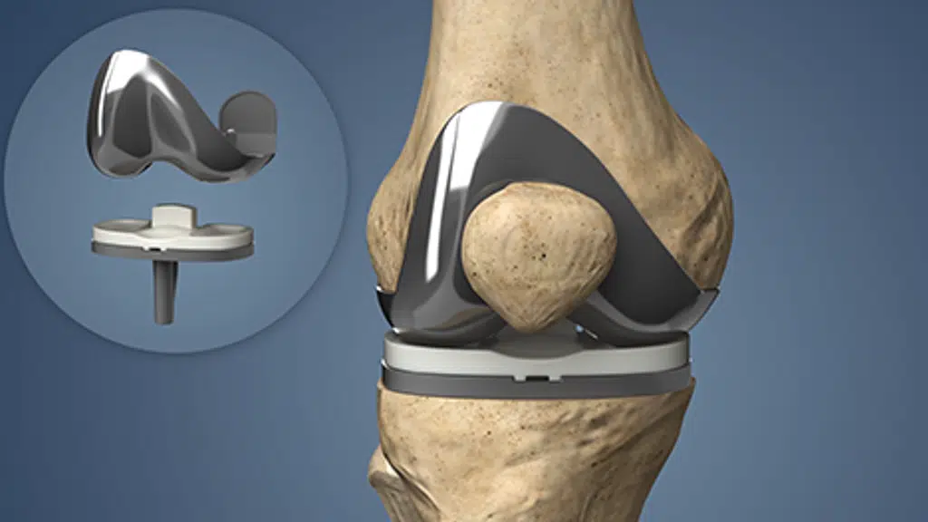 Dr.Vinoth's Advanced Ortho & Diabetes Clinic | Dr.VINOTH Top Knee & Shoulder Surgeon at Adyar.