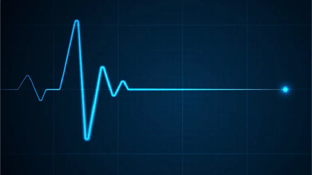 Pulse