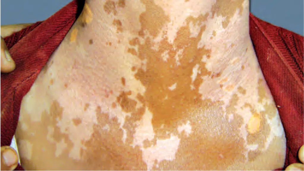 Skin Laser Centre