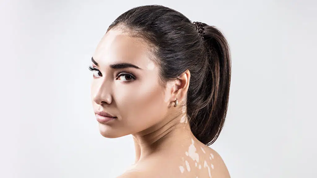 Maharshi Skin Centre