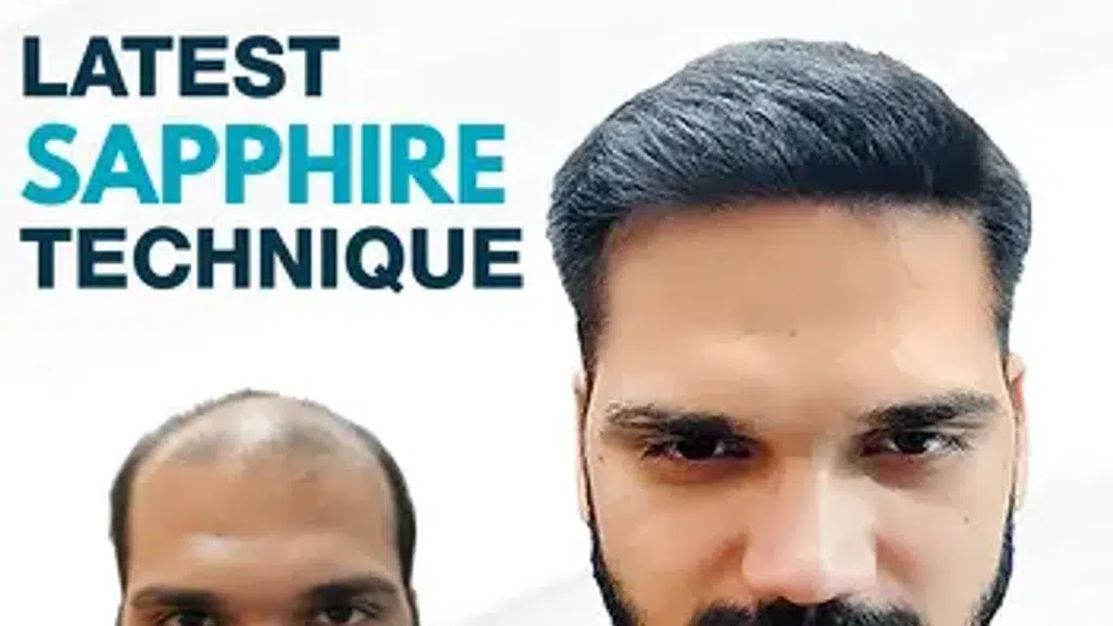 Neoaesthetica Hair Transplant Clinic
