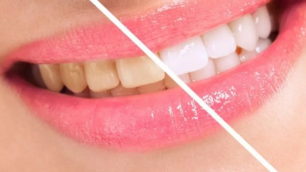 Vista Dental Care