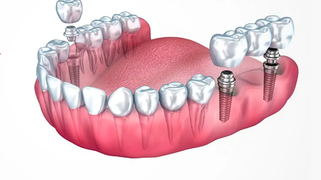 Dentmate Dental Care