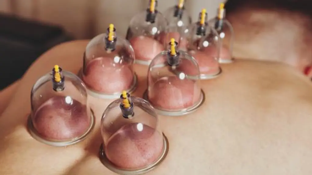 Buddha Top Physiotherapy Center  | Cupping Therapy | Comprehensive Home Services