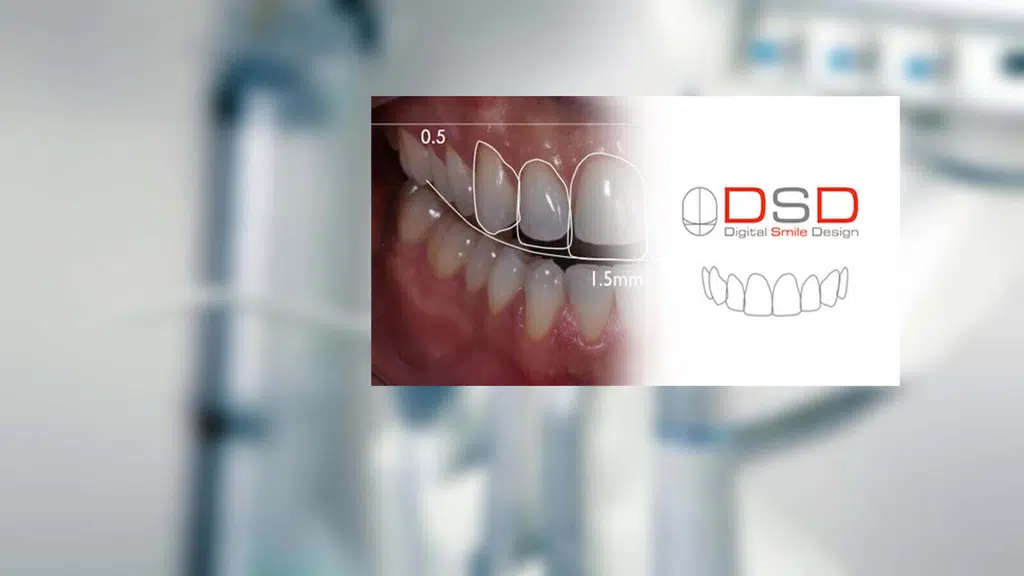 Welldent Digital Smile Designing Centre