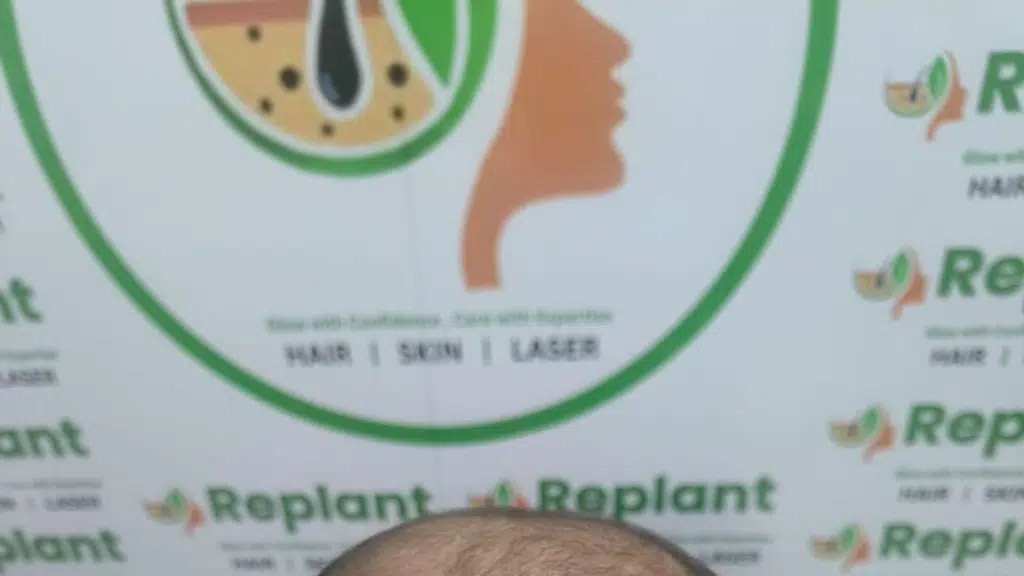 Replant Clinic Bhubaneswar