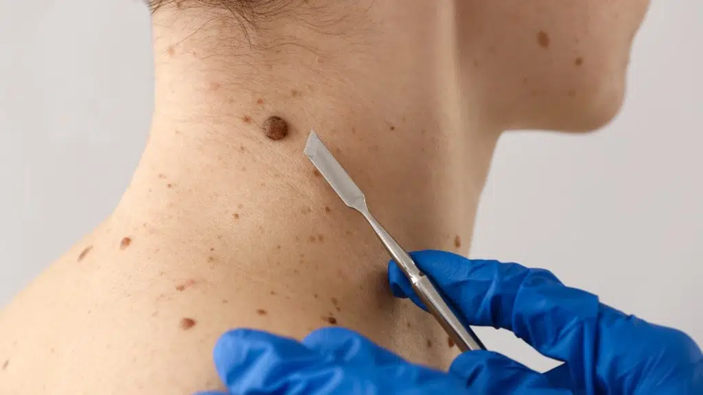 Cosmetica Skin & Hair Transplant