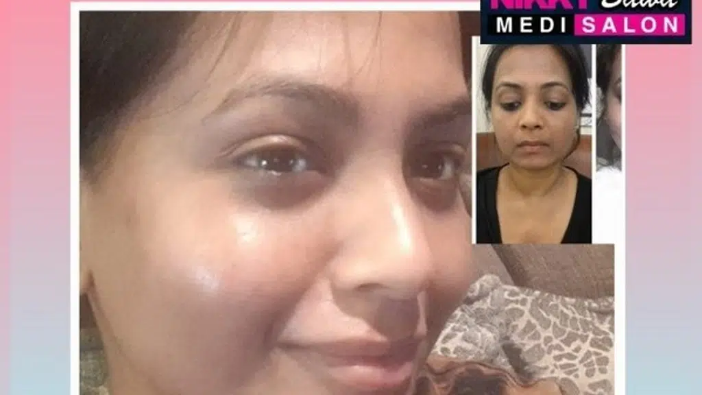 Aesthetica by Nikky Bawa Medi Salon