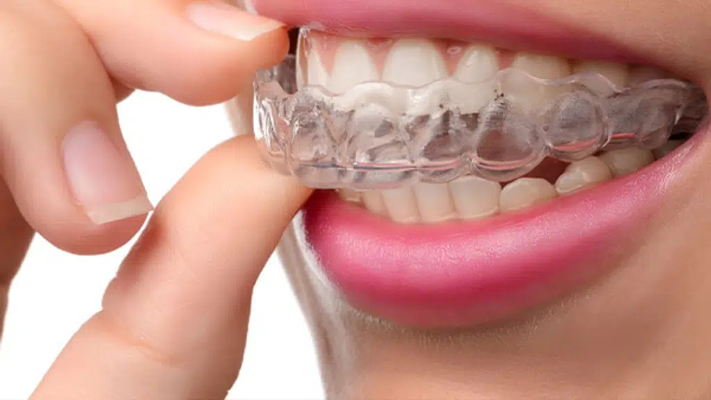 Wisdom Bites Dental Clinic