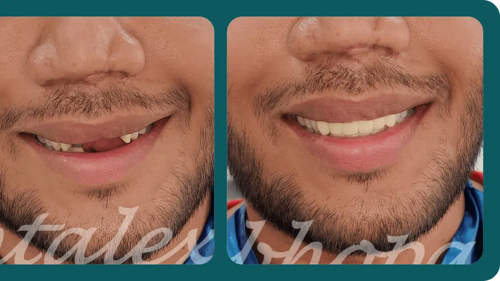Dental Experts Bhopal