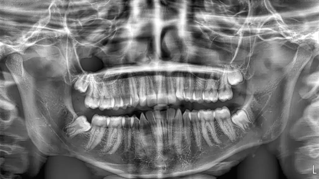 Radiodent-OPG & CBCT Center