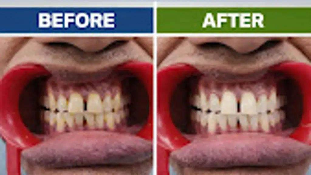 Dr Gupta Dental and Implant Clinic