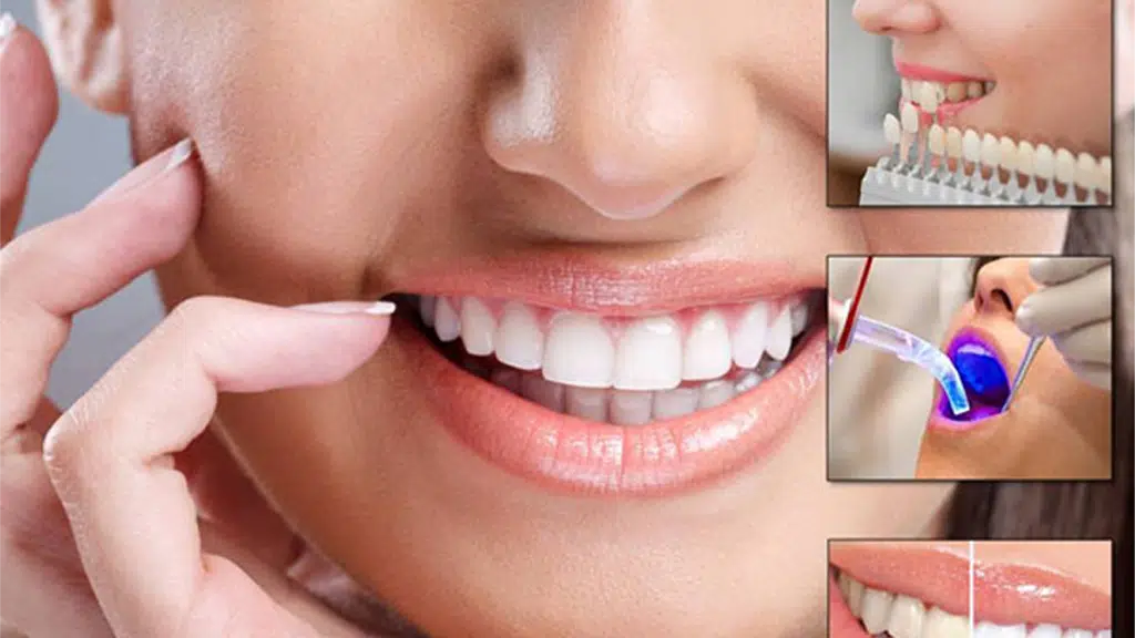 P.S. Perfect Smile Denal Care
