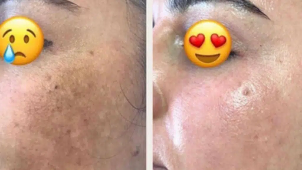 Nyraa Skin Hair Aesthetic and Scan Center