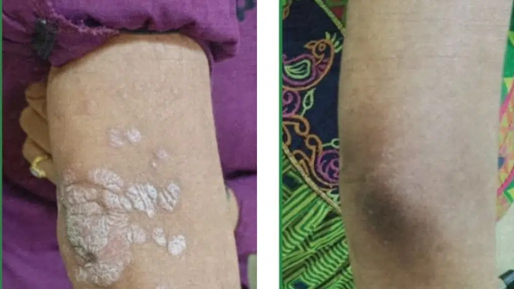 Skinheal Solutions – Dr. Neha Dongaonkar