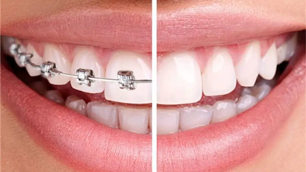 DENTAL LIFE Best Dental Implant clinic