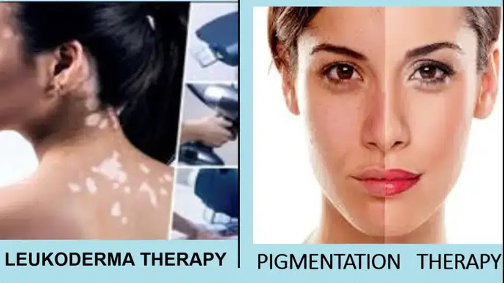 Dr TANNU SKIN CLINIC