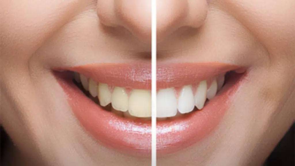 Smayate Dental Clinic