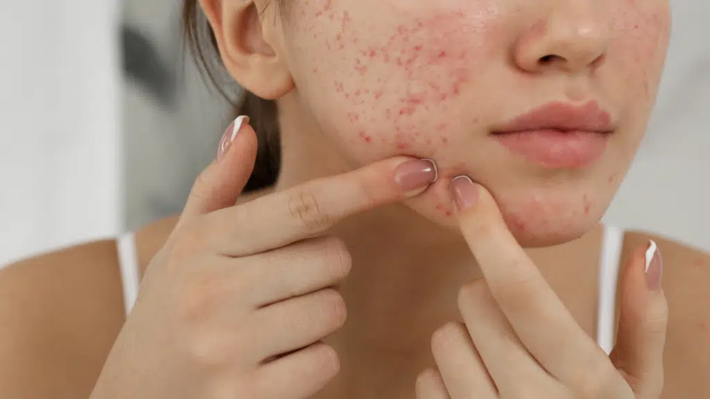 Dermaglow Skin Clinic
