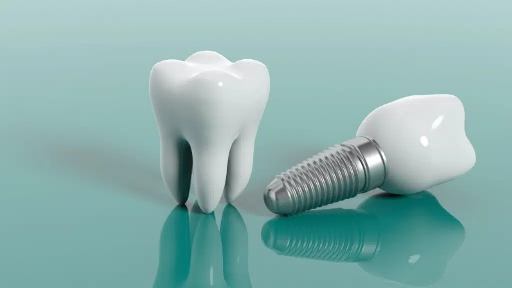 Dr.Dixit's Dental Speciality Clinic and Implant Center