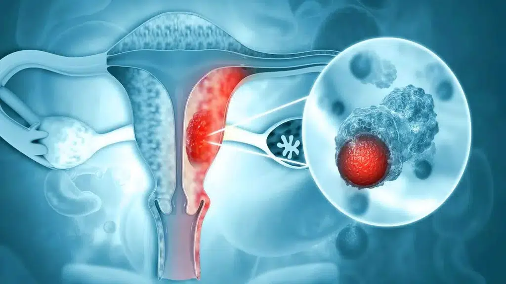 Dr. Aneeta Talwar - Gynaecologist & Gynaecology Endoscopic Surgeon